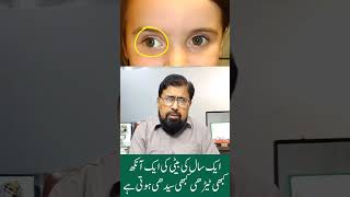 Squint Eyes Correction In Babies Bachon Me Bhengapan Ka Ilaj Urduhindi