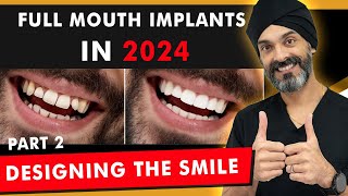 Full Mouth Dental Implants in 2024 - Part 2: The Teeth