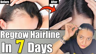 7 Days Challenge : Regrow Lost Hairline, Bald Patches & Get Longer, Thicker and Faster Hair Growth screenshot 5