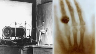 The Invention of the X-Ray Machine: A Groundbreaking Discovery in Medicine screenshot 3