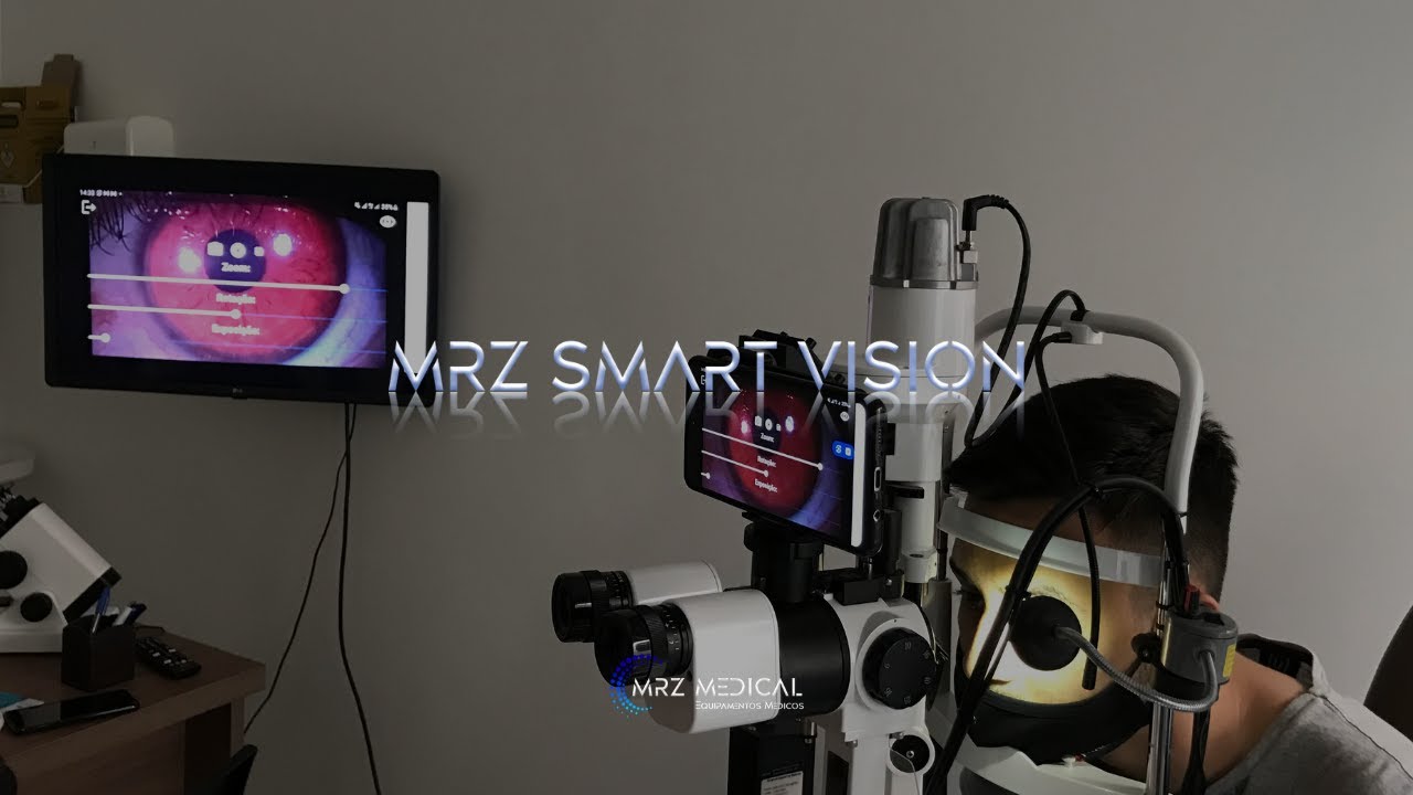 MRZ SMART VISION - Sistema de Imagem Para Lâmpadas de Fenda e Microscópios Cirúrgicos