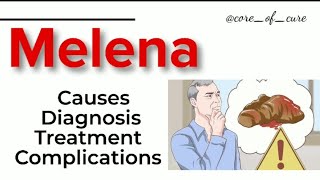 MELENA || CAUSES ||  DIAGNOSIS || TREATMENT ||  COMPLICATIONS