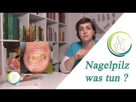 nagelpilz:-was-tun?