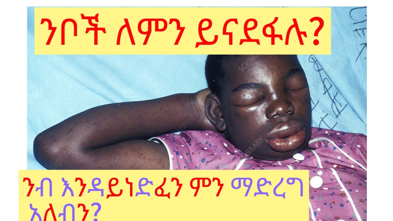 ንቦች ለምን ይናደፋሉ?                          September 16, 2025