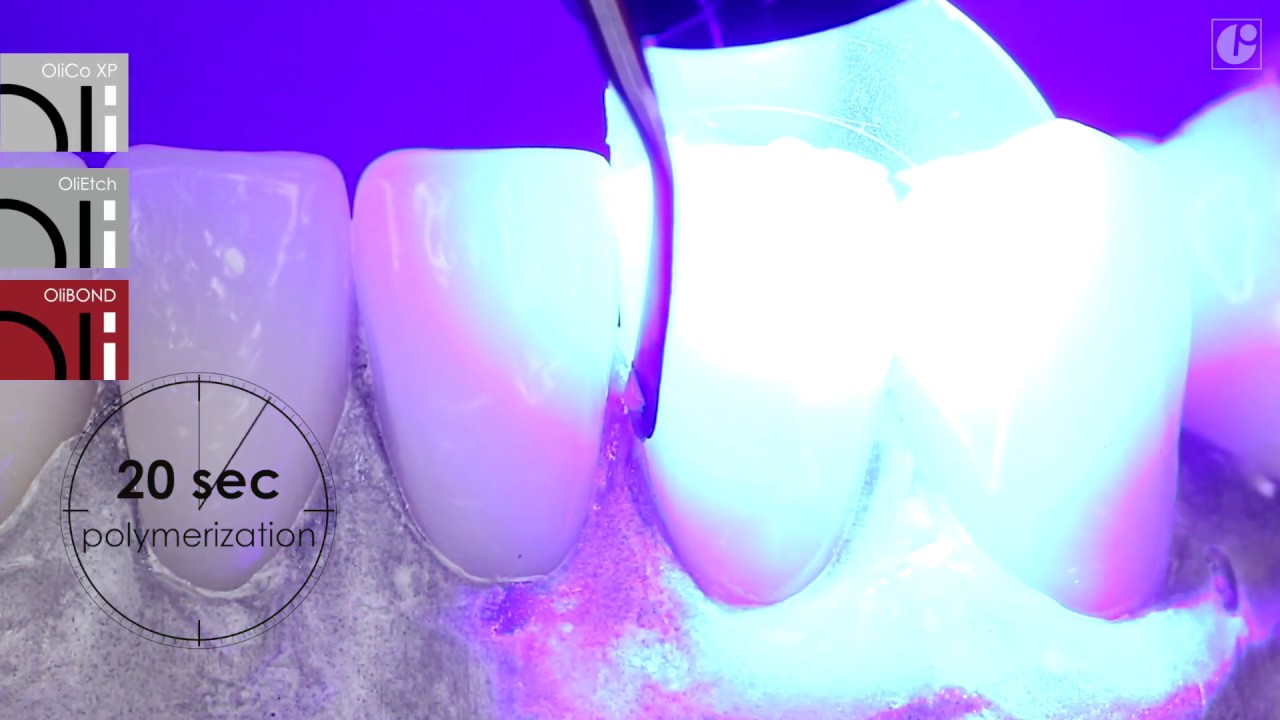 OliCo XP - OLIDENT [EN]