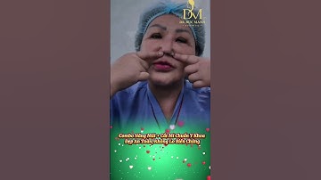Combo Nâng Mũi & Cắt Mí – Thăng Hạng Nhan Sắc, Tỏa Sáng Mọi Góc Nhìn #lamdep