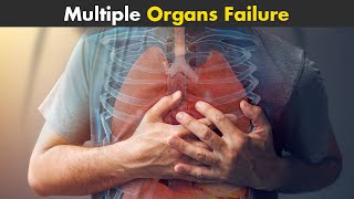 Multiple Organ Failure (MOF) | Symptoms, Causes And Treatment (Urdu/Hindi)