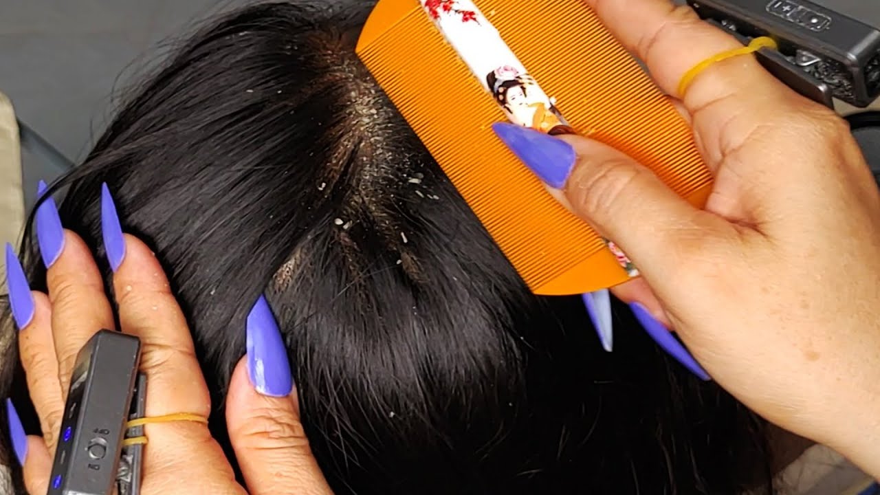 Ultimate Flake Comfort Session ASMR 🌜 | Long Nail Scratching & Itch Relief 