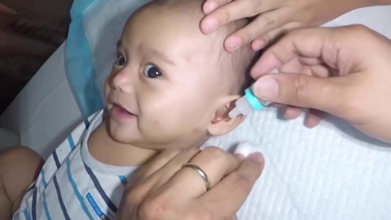 Cute 3 Month Old Baby Boy's Earwax Removal YouTube