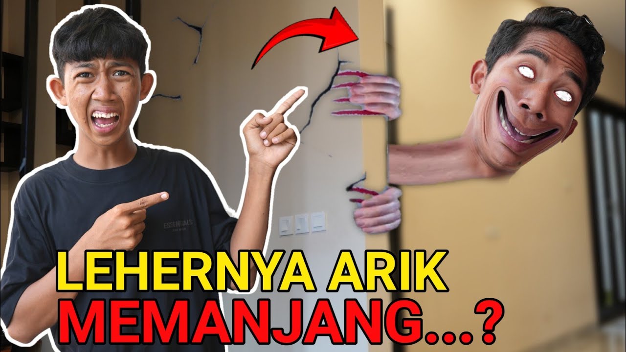 ARIK LEHERNYA GAK BISA BERHENTI TUMBUH MEMANJANG😱!! KOK BISA Toollloonggg!! | Mikael TubeHD