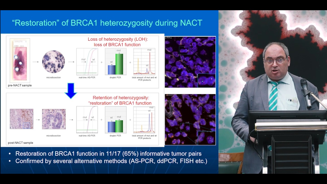 Метастатическая меланома: молекулярное тестирование материала первичной ...