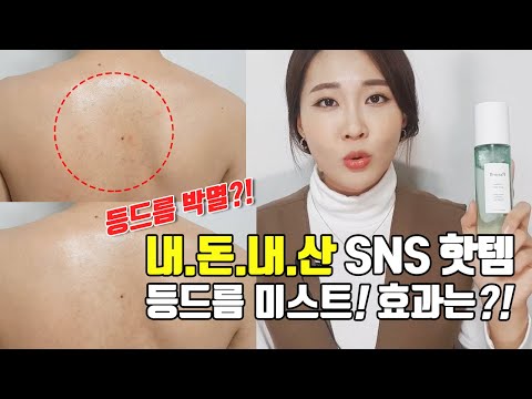 [SNS대란] 등드름 없애는 법? 2주만에 등드름이 없어졌다?!