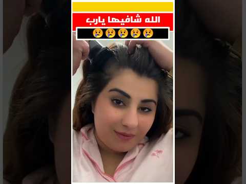 قطعات شعرها - قطعات شعرها