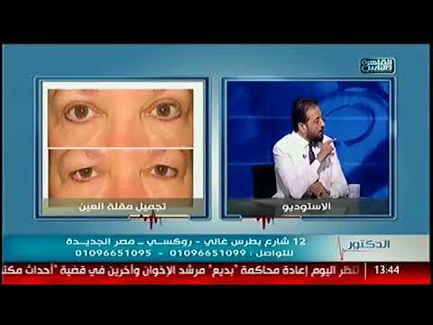 دكتور ضياء عابدين يشرح ما هو تجميل مقلة العين