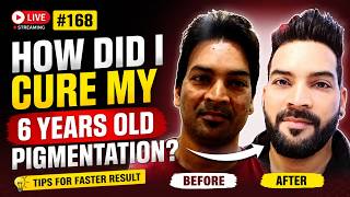 How did I cure Pigmentation in 6 months? Sunday Live #168