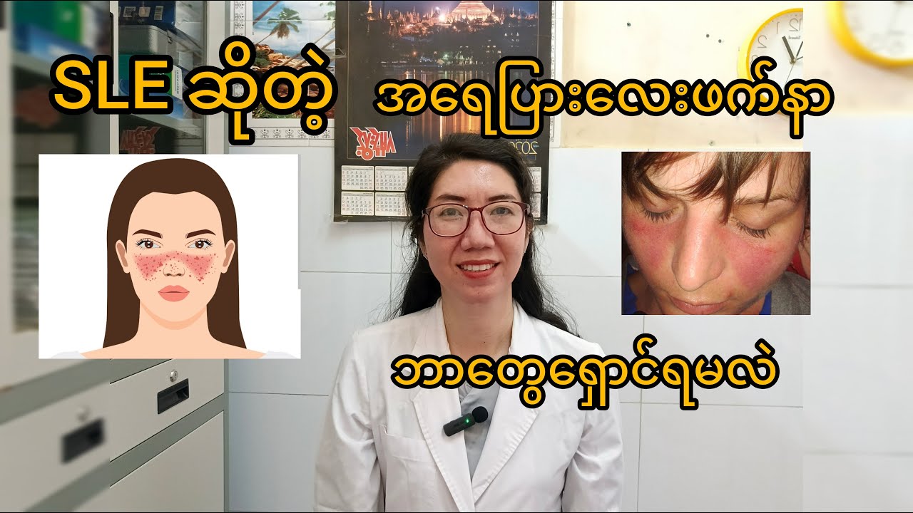 အရေပြားလေးဖက်နာ ဘာလို့ဖြစ်လဲ နှင့် သိချင်တဲ့မးခွန်းအ ဖြေတွေ