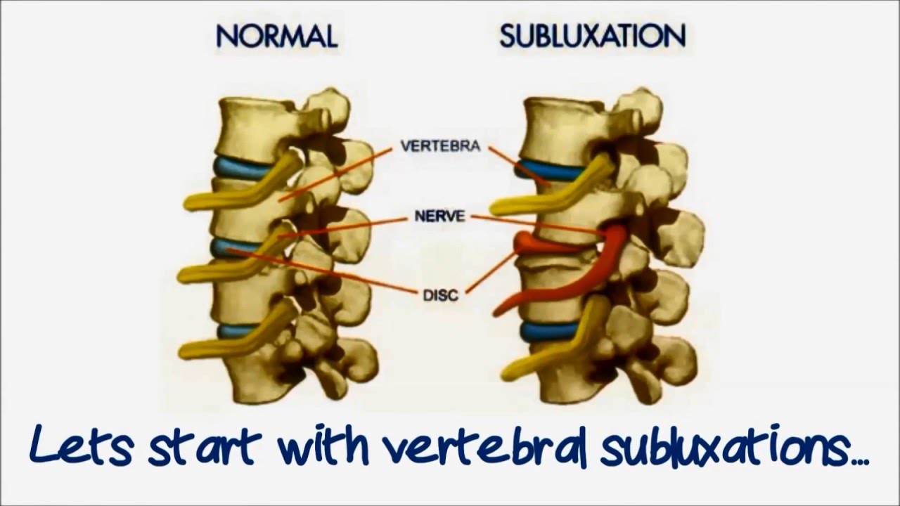 Rehabilitation From Sports Injury