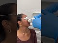 One of my all time favorite treatments for YEARS now