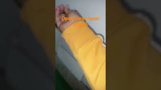 Opan clean laser ir2625 Opan clean laser ir2625