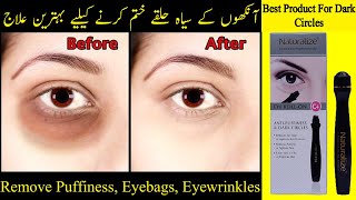 How To Remove Dark Circles Urdu\Hindi | Ankhon Ke Halke Khatam | Under Eye Circles | Dark Puffy Eyes