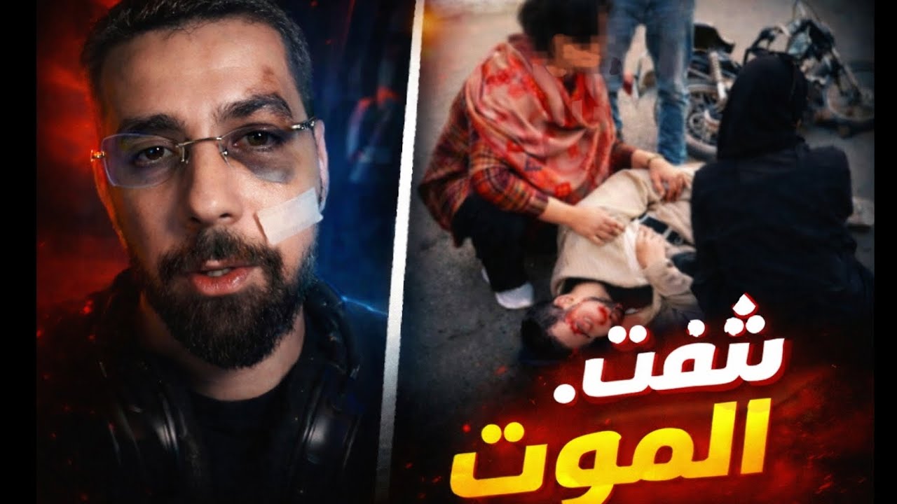 Ahemad sabiri Kan Radi yemot 😖 wax sab