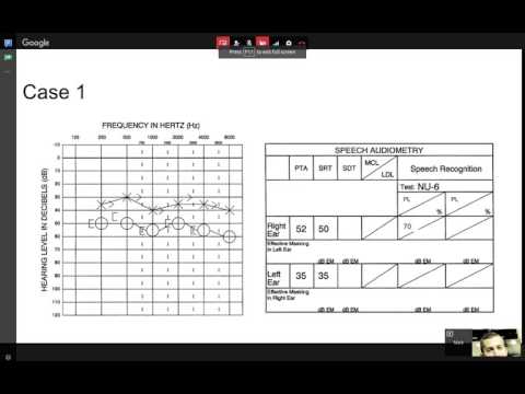 Speech Audiometry Practice (tewfiqsiliman@yahoo.com)