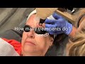 Erbium Skin Resurfacing at Pure Image Laser and Spa