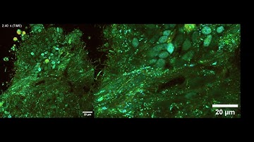 Real-time, high-resolution, label-free, non-invasive imaging within optically thick sample