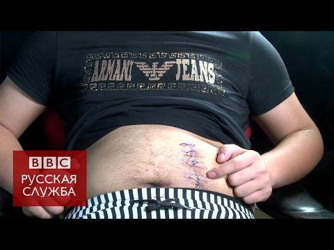 Торговля органами в Китае: почка за $7 тыс. - BBC Russian