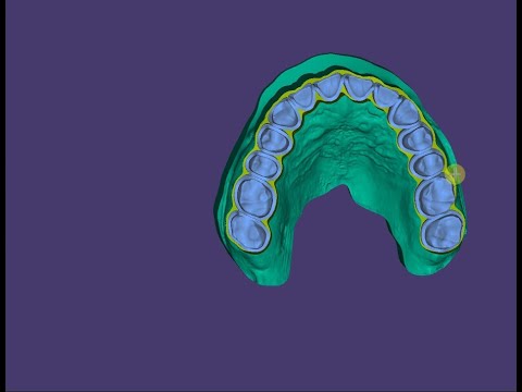 exocad Tutorial: Digital Prep Model