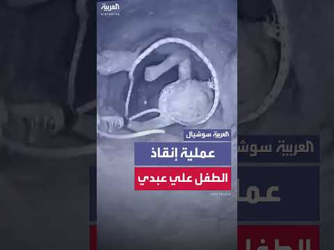 إنقاذ الطفل علي صالح عبدي من بئر عمق 50 متراً شمال الرقة