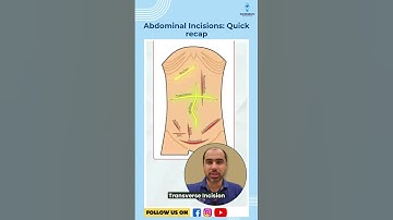 Abdominal Incisions: Quick recap | Dr. Amrit Nasta