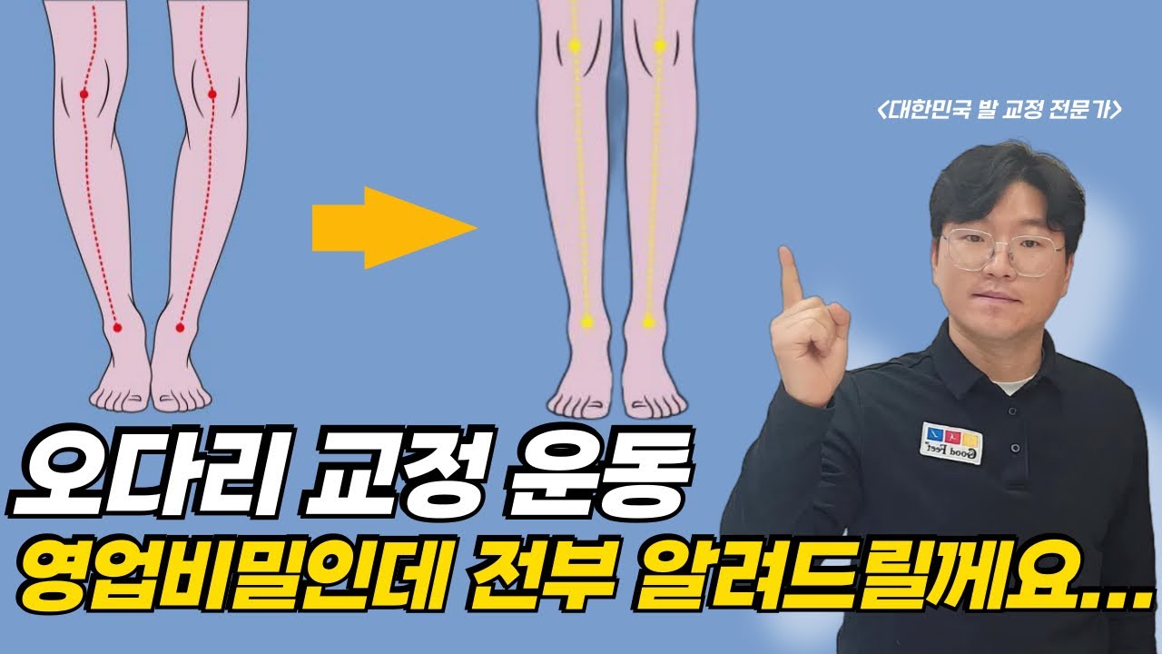 바로효과 보는 오다리 교정운동 (O다리, 휜다리 교정)