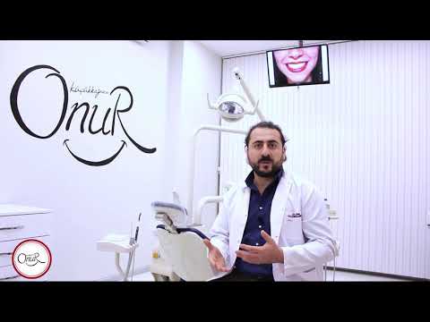 Konya Özel Diş Hekimi Onur Küçükkağnıcı - Diş Beyazlatma Konya Özel Diş Hekimi Onur Küçükkağnıcı - Diş Beyazlatma