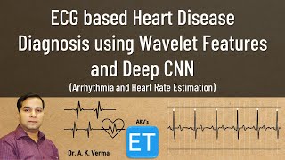 ECG Based Heart Disease Diagnosis using Wavelet Features and Deep CNN screenshot 4