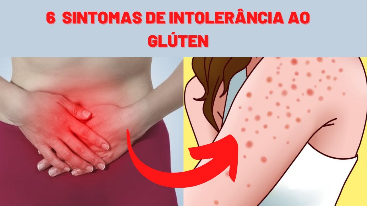 6 Sinais de Intolerância ao Glúten Que Você Ignora - YouTube