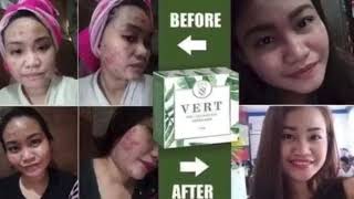 Vert 8 in 1 All Natural Green Soap screenshot 5