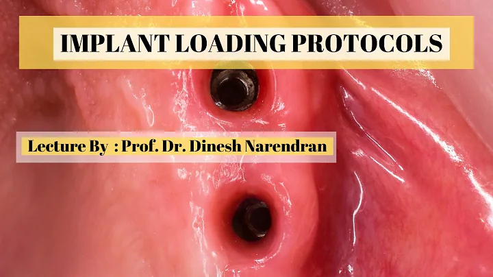 IMPLANT LOADING PROTOCOL - LECTURE | LOADING CONCEPTS IN IMPLANT DENTISTRY