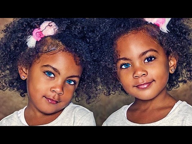 Remember The Most Beautiful Black Twin Girls In The World? This is How They Look Now! class=