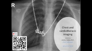 II. Radiology lecture - Chest and cardiothoracic imaging