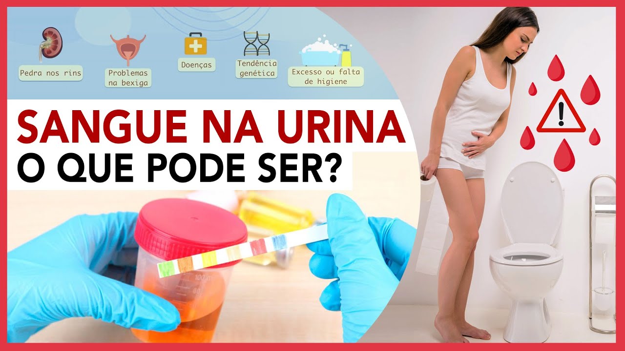 SANGUE NA URINA - O que pode ser? - YouTube