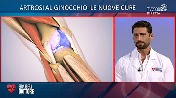 Quando ci si opera al ginocchio?