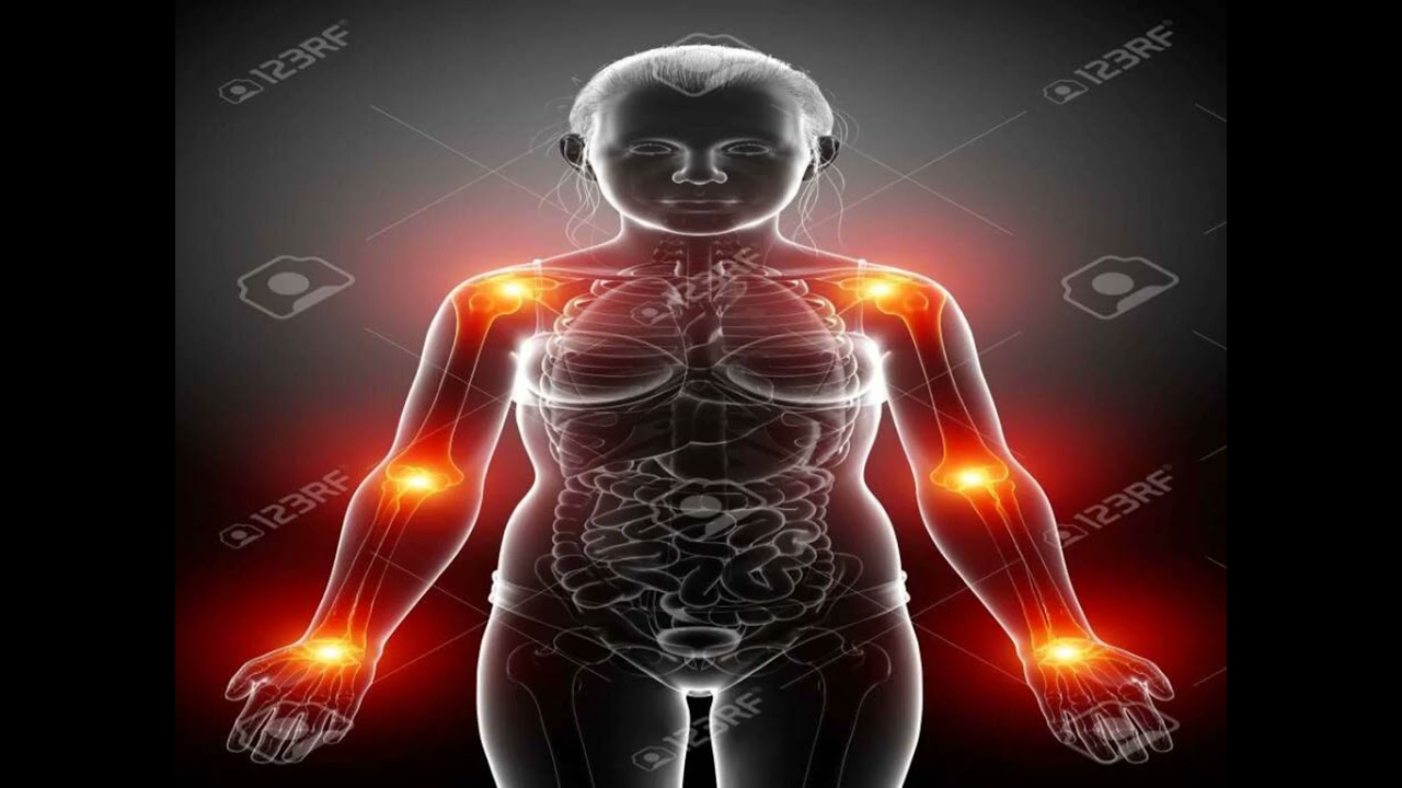 Artrivit Ulasan Suplemen Penghilang Rasa Sakit Sendi