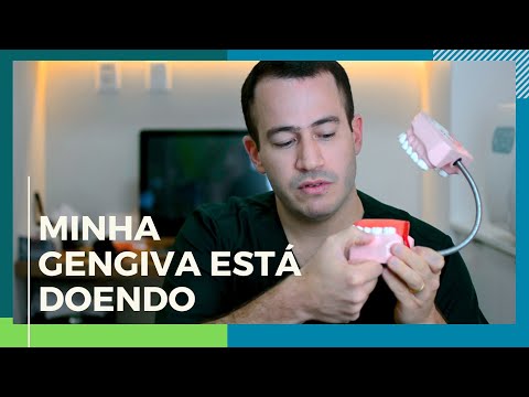 Vídeo: Onde está localizada a gengiva?