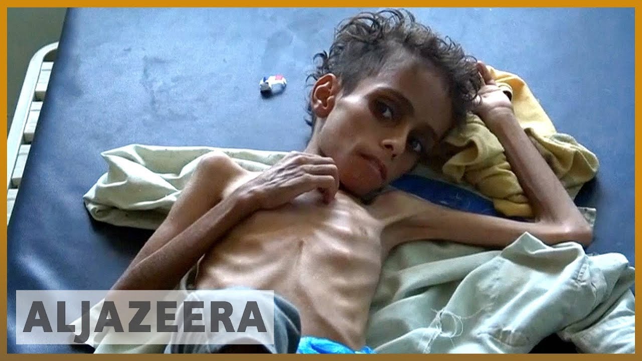 حرب اليمن: محادثات برعاية الأمم المتحدة على وشك الانطلاق | الجزيرة الإنجليزية