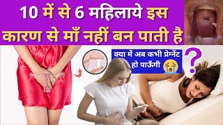 महिला में ऐसे रंग का डिस्चार्ज हो तो माँ नहीं बन पाती ??🤔 WHITE DISCHARGE & PERIODS - कारण और इलाज screenshot 2