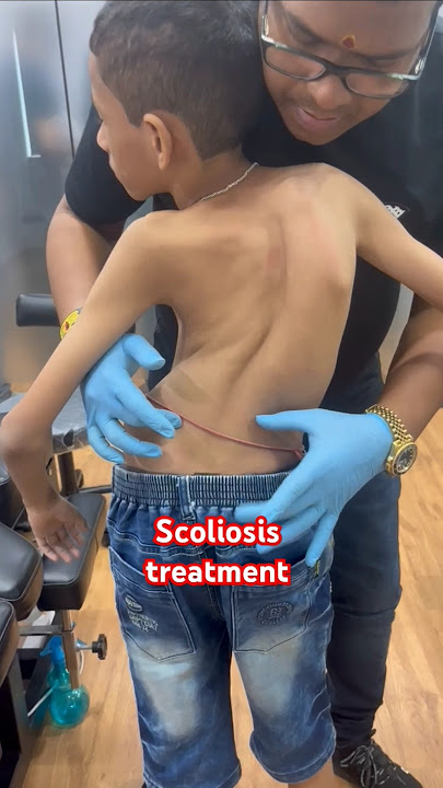 #chiropractor  #Scoliosistreatment #rkm  #drrajneeshkant