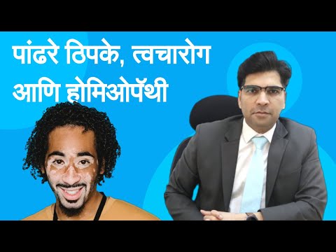 पांढरे ठिपके, त्वचारोग आणि होमिओपॅथी - Homeopathy Treatment of Vitiligo in Marathi