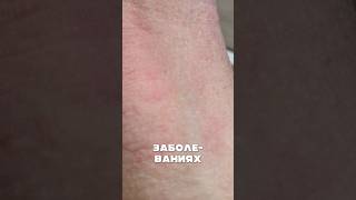 Топ препаратов для заживления кожи #shorts