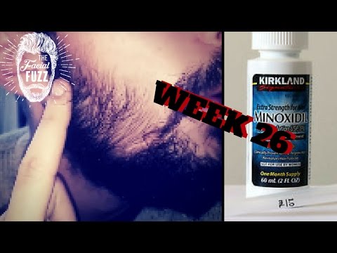 Minoxidil Beard | Week 26 | 6 Months!!! | The Experiment | #Facialfuzzfridays